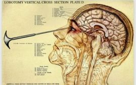 a86a301eeab41bdb6087fc5ccc7bfbd6_XL